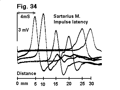 Sartorius Impulse Latency