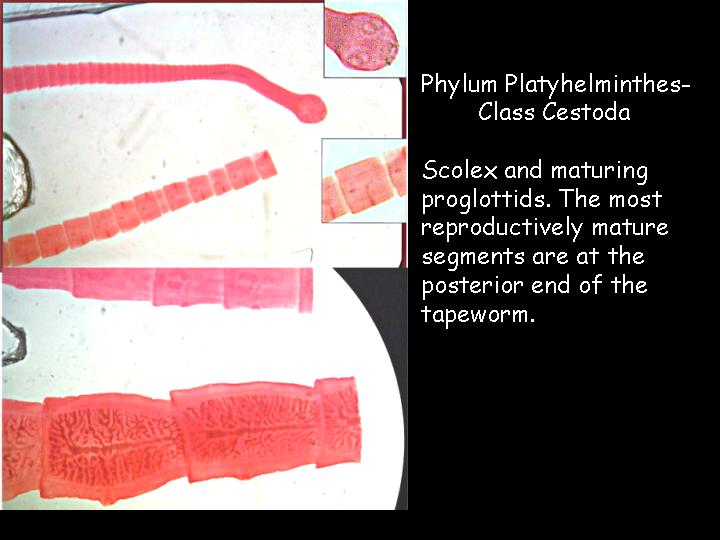 cestoda platyhelminthes infected papilloma icd 10