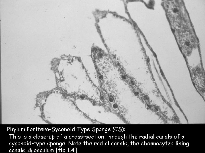 Kingdom Animalia- Phylum Porifera