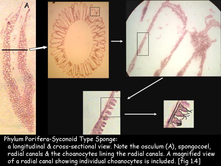 Leucosolenia Cross Section Leucosolenia Cross Section