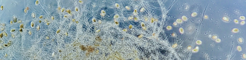 blue protozoa